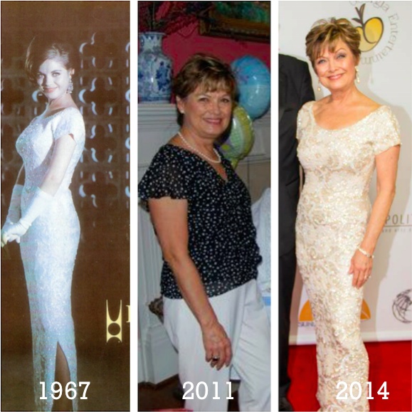 Glenda Young Before and After (1)